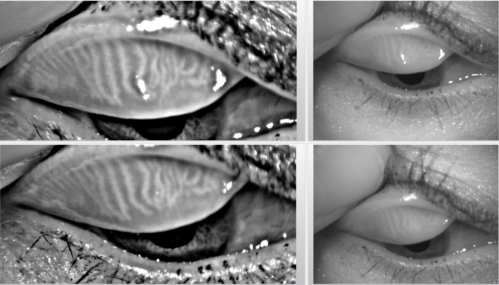 Castelberg Tränenanalyse.jpg